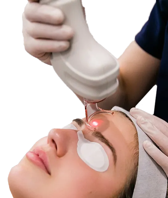 co2-laser-treatment.webp