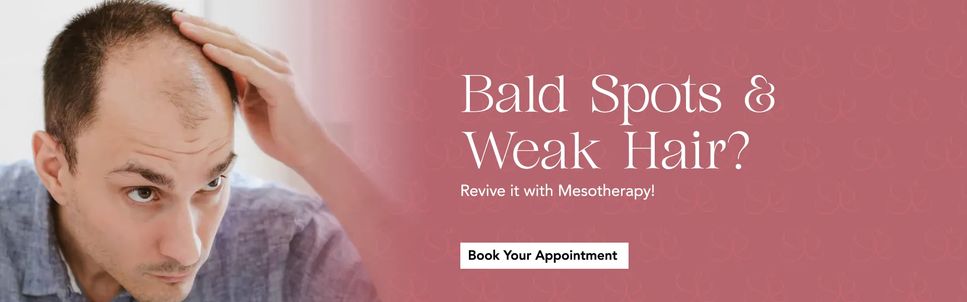 mesotherapy-service.webp