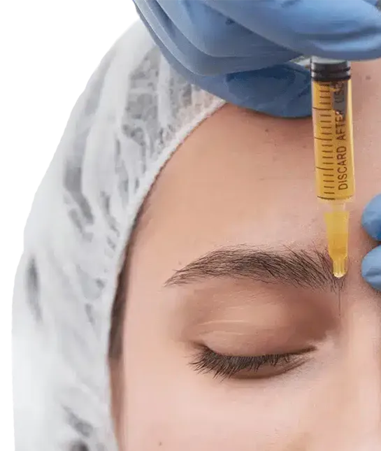 mesotherapy-work1.webp