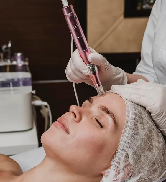 CO₂ Laser Treatment